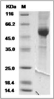 Cynomolgus NKG2A / NKG2 / CD159A / KLRC1 Protein (Fc Tag) SDS-PAGE