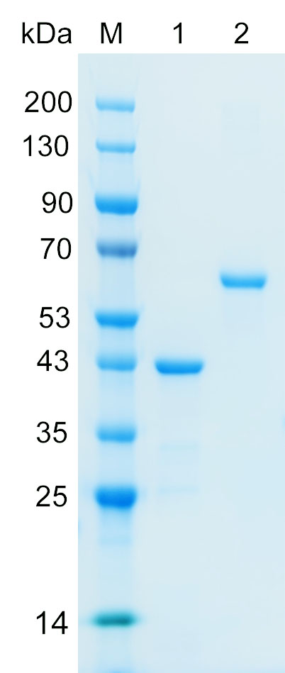 Recombinant AMOL1 protein (His tag) SDS-PAGE
