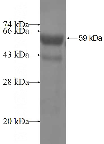 Recombinant Human GNL1 SDS-PAGE