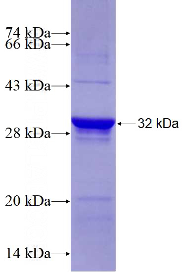 Recombinant Human ELTD1 SDS-PAGE