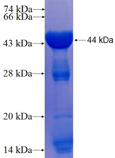 Recombinant Human TRAF5 SDS-PAGE