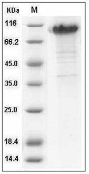 Rat KIM-1 / TIM1 / HACVR1 Protein (His & Fc Tag) SDS-PAGE