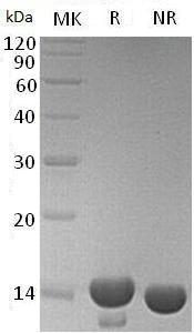 Human CST3 recombinant protein