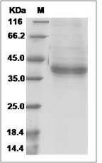 Human PRRG2 Protein (Fc Tag)