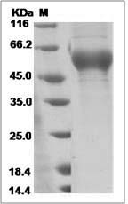 Influenza A H3N2 (A/Indiana/07/2012) Hemagglutinin / HA1 Protein (His Tag)