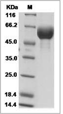 Human FGFR3 / CD333 Protein (alpha(IIIb), His Tag)