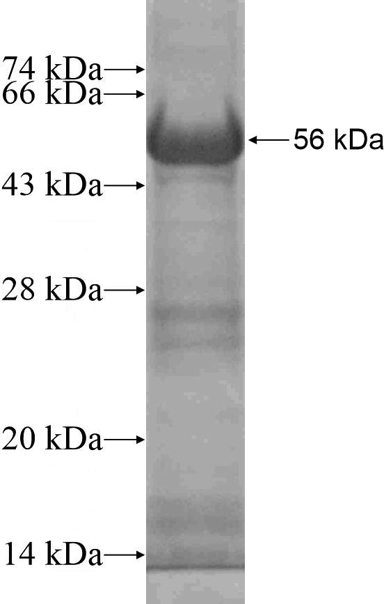 Recombinant Human ZZZ3 SDS-PAGE