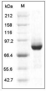 Human AKT3 Protein (GST Tag) SDS-PAGE