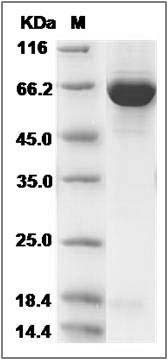 Human GBP-2 / GBP2 Protein (His Tag) SDS-PAGE