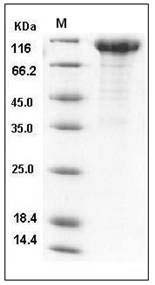 Influenza A H1N1 (A/California/04/2009) Neuraminidase / NA (Fc Tag) SDS-PAGE