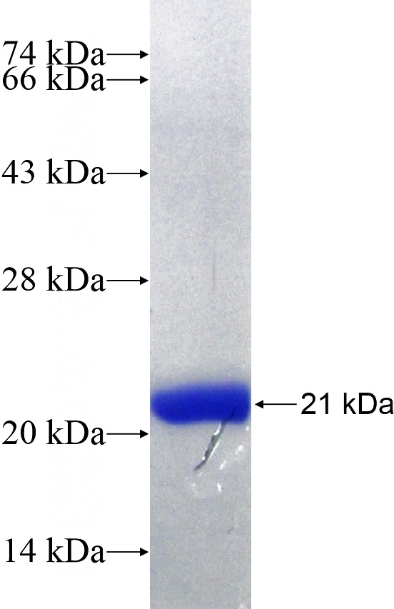 Recombinant Human PSMD9 SDS-PAGE