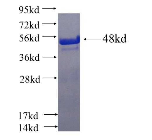 Recombinant human NNT SDS-PAGE