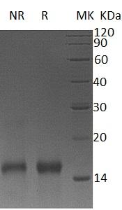 Mouse Btc/mCG_12529 (His tag) recombinant protein