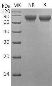 Human LY9/CDABP0070 (His tag) recombinant protein