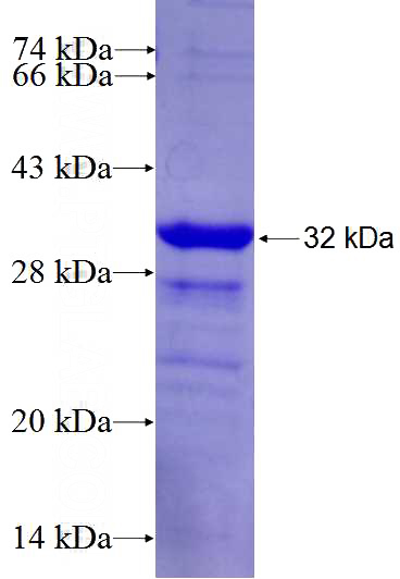 Recombinant Human LIME1 SDS-PAGE
