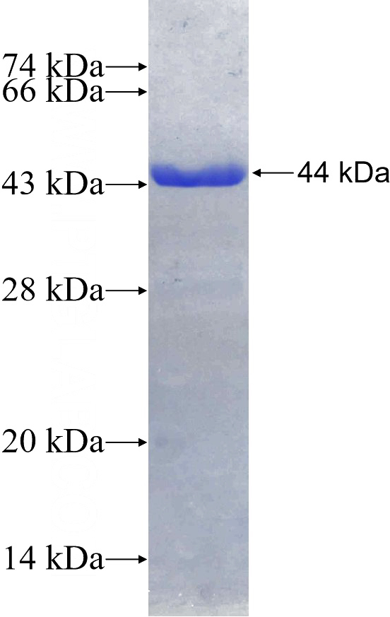 Recombinant Human ADAT2 SDS-PAGE