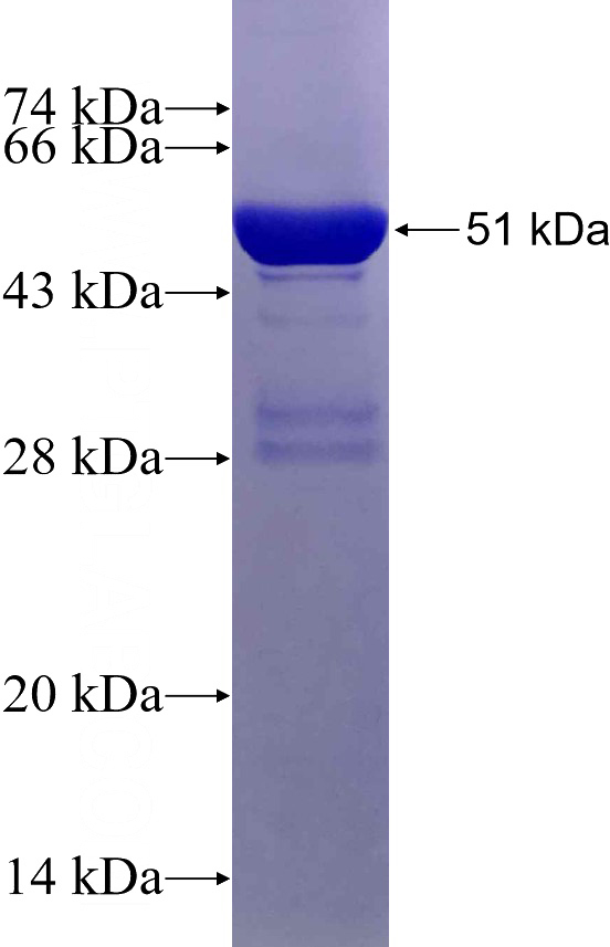 Recombinant Human C20orf11 SDS-PAGE