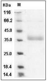 Human NCR2 / NKp44 / CD336 Protein (His Tag) SDS-PAGE