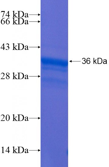 Recombinant Human PRR16 SDS-PAGE