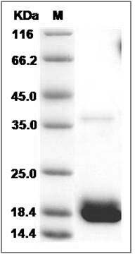 Cynomolgus IFNA13 / Interferon alpha-13 Protein (His Tag) SDS-PAGE