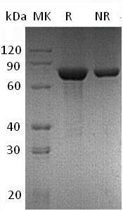 Mouse Tgm2 (His tag) recombinant protein