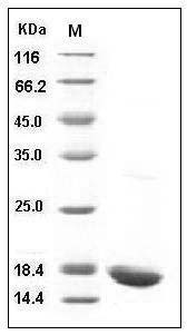 Human IL-1 beta / IL1B Protein SDS-PAGE