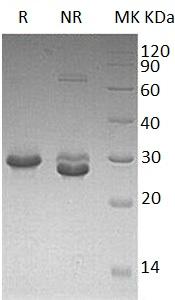 Human TRAT1/TCRIM/HSPC062 (His tag) recombinant protein