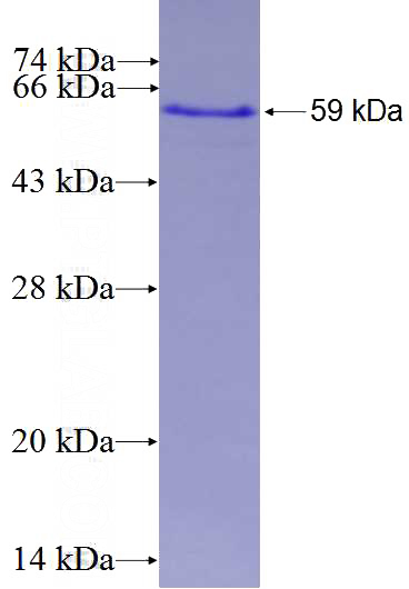 Recombinant Human PCSK2 SDS-PAGE