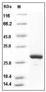 Human MAD2L1 / MAD2 Protein (His Tag) SDS-PAGE