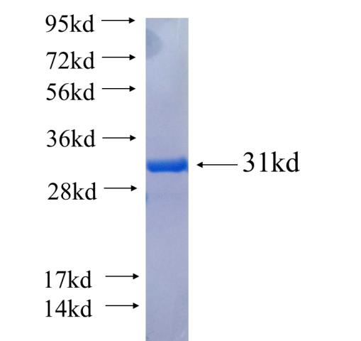 Recombinant human BCLAF1 SDS-PAGE