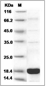 Human SUB1 Protein (His Tag) SDS-PAGE