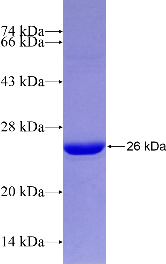 Recombinant Human FIG4 SDS-PAGE