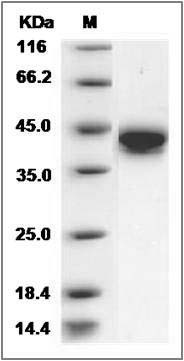 Rat CD38 Protein (His Tag) SDS-PAGE