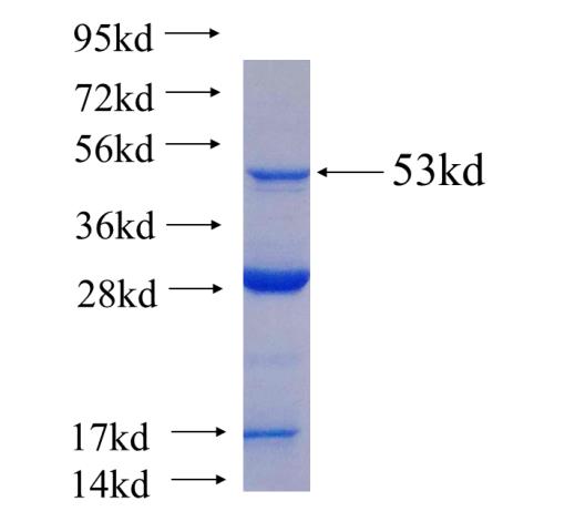 Recombinant human DNAH6(Full length) SDS-PAGE