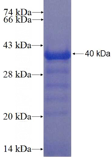 Recombinant Human C3orf39 SDS-PAGE