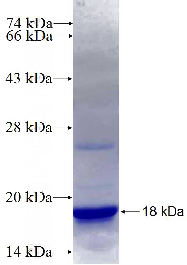 Recombinant Human MTMR1 SDS-PAGE