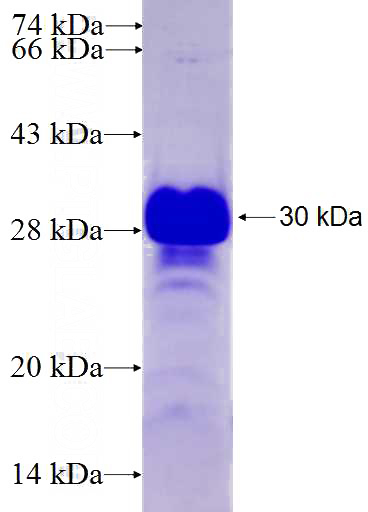 Recombinant Human TOX4 SDS-PAGE