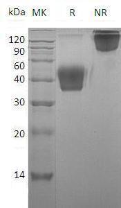 Mouse Csf1/Csfm (His tag) recombinant protein