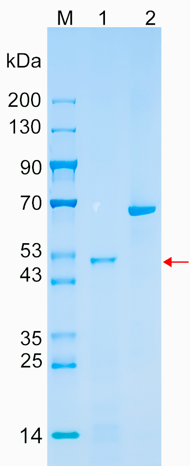 Recombinant GNL3L protein (His tag) SDS-PAGE