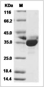 Human PRPS2 Protein (His Tag) SDS-PAGE