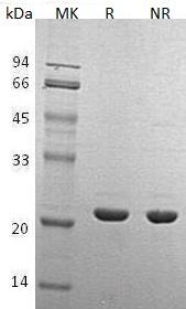 Human CRYAB/CRYA2/HSPB5 (His tag) recombinant protein