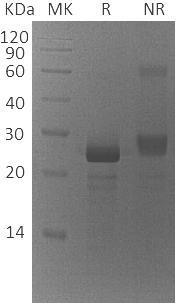 Human ZNF22/KOX15/KROX26 (His tag) recombinant protein