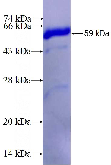 Recombinant Human AKR7A2 SDS-PAGE
