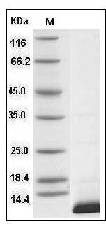 Human S100B Protein (His Tag) SDS-PAGE