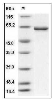 Human CROT Protein (474 Leu/Val, His Tag) SDS-PAGE