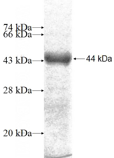 Recombinant Human OLFML3 SDS-PAGE
