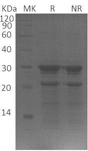 Human PYM1/PYM/WIBG (His tag) recombinant protein