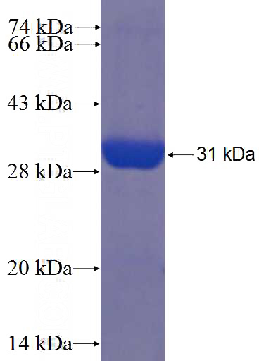 Recombinant Human ZCCHC2 SDS-PAGE