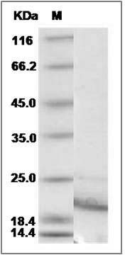 Rat IL21 / Interleukin 21 Protein (His Tag) SDS-PAGE