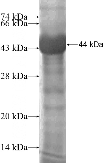 Recombinant Human RNF123 SDS-PAGE